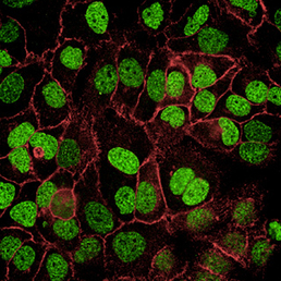 Fluorescent Secondary Antibodies